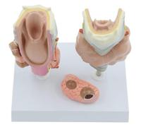 Modelo de anatomía de patología de la tiroides humana, conjunto de modelos de tiroides, modelo de enfermedad de la tiroides humana con tarjeta de instrucciones, for enseñanza y formación