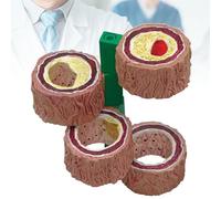 Modelo de Anatomía de Vasos Sanguíneos, Modelo de Aterosclerosis, Modelo de Arteriosclerosis de 4 Etapas, Modelo de Anatomía de órganos Humanos Para Ayuda a La Formación en Enseñanza Médica