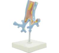 Modelo de anatomía del árbol bronquial del pulmón de patología del sistema respiratorio humano, modelo anatómico del órgano de morfología de la lesión bronquial, for aprendizaje médico, exhibición