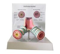 Modelo de anatomía del asma humana, modelo bronquial del sistema respiratorio for estudiantes, modelo de enseñanza de exhibición de estudio, modelo de caso traqueal humano
