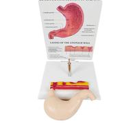 Modelo de Anatomía del Estómago Humano, Modelo de Úlcera Gástrica Patológica con Tarjeta en Inglés y Base de Exhibición, para Educación del Paciente, Investigación Anatómica