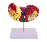 Modelo De Anatomía Del Hígado Humano, Modelo Anatómico Del Hígado | Modelo De Hígado Para Patología Con Estructura Clara - Modelo De Patología Para La Enseñanza Del Hígado, Modelo De Hígado Con De
