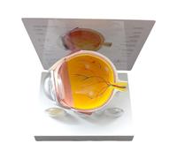 Modelo de anatomía del ojo humano realista patológico para investigación, uso educativo y demostración clínica, PVC