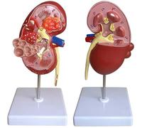 Modelo de anatomía del riñón funcional, 2 piezas desmontables y 24 etiquetas digitales, guía anatómica for demostración educativa