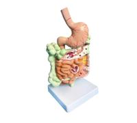 Modelo de anatomía del sistema digestivo humano, modelo de enseñanza desmontable de intestino e intestino grueso con representación de patología, pedestal cuadrado anatómico