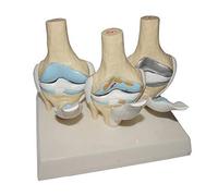 Modelo de anatomía Esqueleto, Conjunto de Modelos de articulación de Rodilla, patología artrítica de Rodilla, anatomía del Cuerpo Humano, osteoartritis, articulación de Rodilla para médicos,