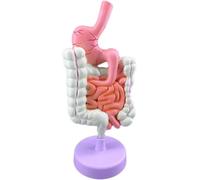 Modelo de anatomía gastrointestinal del estómago humano, modelo de sistema digestivo patológico, modelo de enfermedad del intestino delgado grande con estructura desmontable, for exposición