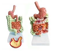 Modelo de anatomía gastrointestinal Humana, Modelo del Sistema digestivo Humano, Modelo de Enfermedad del Colon, Estructura de los órganos internos para la enseñanza en Pantallas