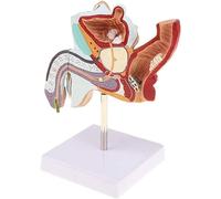 Modelo de anatomía genital masculina: herramienta educativa sobre enfermedades urológicas for la formación médica