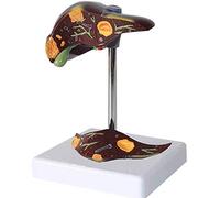 Modelo de anatomía hepática humana, modelo de patología hepática de recursos de estudio, modelo de anatomía humana, investigación científica y observación médica