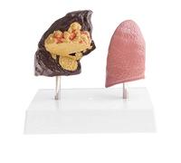 Modelo de anatomía Modelo de anatomía, pulmón patológico, pulmones sanos, Modelo comparativo, sección de Corte de órgano, anatomía con Instrucciones, Modelo de comparación de pulmón 1: 1 y p