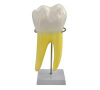 Modelo de anatomía molar humana modelo de enseñanza molar con base estable para enseñanza dental y educación médica de dientes anatómicos