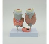 Modelo de anatomía patológica de la tiroides, modelo de lesiones tiroideas humanas, modelo de nódulo tiroideo, modelo de enseñanza de anatomía del sistema endocrino humano para estudios de ciencias en