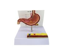 Modelo de anatomía patológica del estómago, modelo anatómico de perforación gástrica, herramienta de enseñanza para el aula para el ajuste clínico, herramienta de entrenamiento
