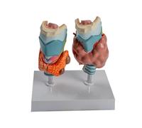 Modelo de anatomía patológica humana de la tiroides para estudiantes médicos, modelo anatómico para enseñanza en el aula