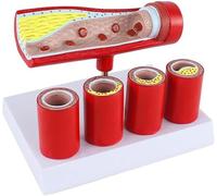 Modelo de arteria cardiovascular: anatomía similar a la de una arteria coronaria for la enseñanza de patología y formación de esclerosis.