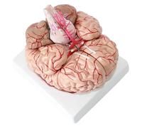 Modelo de arteria cerebral, modelo anatómico del cerebro humano, desmontable, for investigación en neurociencia y aprendizaje médico.