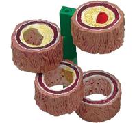 Modelo de arteria de 4 Piezas - Modelo de aterosclerosis - Modelo de réplica de anatomía, Modelo de Esclerosis y trombosis, Herramienta educativa Escolar de PVC sólido