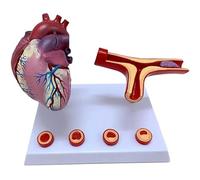 Modelo de bypass coronario, modelo de trombosis por obstrucción de vasos sanguíneos, modelo de corazón humano para uso en aulas y estudios de cardiología.