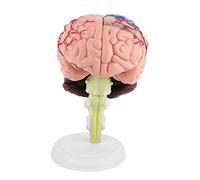 Modelo de cerebro, modelo anatómico humano desmontado, estructura colorida 4D, herramienta de aprendizaje de enseñanza para estudio anatómico general