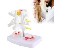 Modelo de Columna Humana, Modelo de Hernia de Disco Lumbar Anatómico Humano, Material de Entrenamiento Escolar de Columna Humana, Excelente Manera de Demostrar el Disco, Restaurar los Detalles de la C