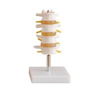 Modelo de Columna Lumbar Humana 1: 1 Modelo de Columna Lumbar de 4 segmentos de tamaño Natural con Pantalla de enseñanza médica básica Modelo Recursos de enseñanza médica
