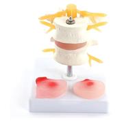 Modelo de Columna Vertebral Humana con Disco intervertebral Lumbar de Dos Secciones. Modelo anatómico médico for demostración de Hernia discal Lumbar. Material didáctico for el Aula.