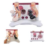Modelo de comparación de alvéolos sanos y fumadores, modelo anatómico alveolar humano modular con tarjeta trasera en inglés, for enseñanza de la salud, consulta e investigación de pacientes
