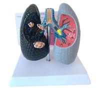 Modelo de comparación Salud Humana y pulmón Fumador, visualización anatomía broncopulmonar Saludable Versus tabaquismo, con Tarjeta Trasera en inglés, enseñanza médica educación Sanitaria