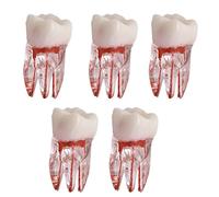 Modelo de conducto radicular dental de 5 piezas para práctica RCT, cavidad pulpar, resina transparente, diente individual para modelo Dental Dtudy