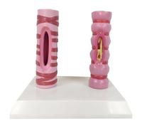 Modelo de Contraste de tráquea Humana, anatomía de los órganos, Estructura del Sistema respiratorio, tráquea Humana Sana y Modelo de comparación patológica - Patología, Modelo de comparación
