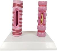Modelo de contraste de tráquea humana, tráquea humana sana y modelo de comparación patológica, material didáctico de estructura del sistema respiratorio, for aprendizaje e investigación médica