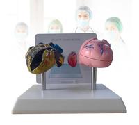 Modelo de corazón de fumador y modelo de corazón sano con características patológicas y estructura anatómica precisa para demostrar los efectos del tabaquismo en la salud cardíaca.
