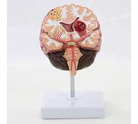 Modelo De Cuerpo Humano: Modelo Anatómico del Cerebro Cardio Cerebrovascular para Personas Mayores, para La Enseñanza De La Investigación, Mejor Comunicación con Los Pacientes