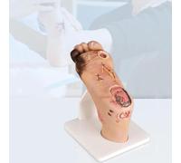 Modelo de cuidado del pie diabético, incluye lesiones purulentas de heridas grado 1-5, placa de pie graduada para entrenamiento de anatomía y fisiología(Severe 4~5level)