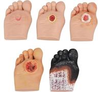 Modelo de cuidado del pie diabético, lesiones de heridas purulentas de grado 1 a 5, modelo simulador de pie diabético for anatomía, fisiología y herramienta de demostración de cuidado de heridas.