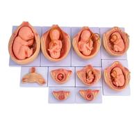 Modelo de Desarrollo Fetal de 9 Meses, Modelo de Desarrollo Embrionario Anatómico Médico para Embarazo, Tamaño 1:1, 10 Piezas, para Estudios de Educación Médica