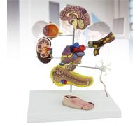 Modelo de diabetes compuesto por 8 piezas, modelo de diabetes para medicina humana, complicaciones de la diabetes para la enseñanza de anatomía y fisiología humanas.