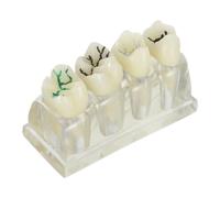 Modelo de Dientes Cariados Educativo de Anatomía Oral Abs