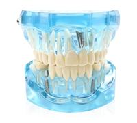 Modelo De Dientes Compatible,Modelo De Dientes Desmontable,Modelo De Dientes Dentales Estándar Para Educación,Demostración Clínica Y Demostración Para Pacientes(Azul)