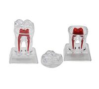 Modelo de Dientes dentales de 2 Piezas - Modelo de Dientes extraíbles Modelo de Dientes de anatomía - Modelos de educación Dental Modelos de Ciencias de Cuidado Dental - para Estudio Modelo