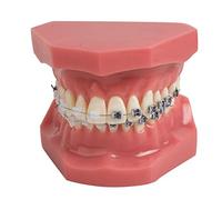 Modelo de Dientes Dentales de Ortodoncia Profesional Modelo de Pantalla de Ortodoncia con Brackets Cerámicos y Brackets Metálicos para el Aprendizaje Investigación y Enseñanza de Odontología