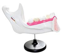 Modelo de Dientes dentales dentición Dental y Modelo de anatomía Molar Modelo de demostración de Dientes para Ayuda de Entrenamiento