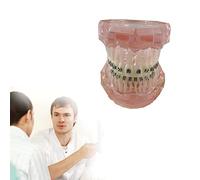 Modelo De Dientes Dentales Estándar, modelo de dentadura de demostración de tipodonto para adultos con soportes de metal para enseñar, estudiar, comunicación con el paciente