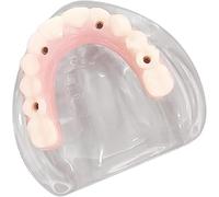 Modelo de dientes dentales, modelo de implante dental con prótesis de puente, estudio de dientes de adultos, enfermedad patológica dental, enseñanza de implantes, modelo de tipodonto for estudios e in