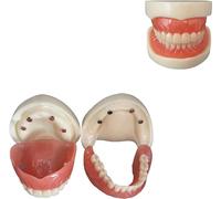 Modelo de dientes dentales, modelo de implantes dentales, modelo de dientes dentales, modelos de dientes estándar, modelo de boca de plástico para suministros de educación dental, visualización de