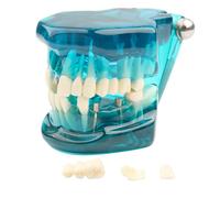 Modelo de dientes enfermedad transparente dental implante Demostración análisis estándar diente entrenamiento tipodont con puente corona extraíble for educación estudiantes (azul)(Blue)