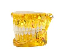 Modelo de dientes enfermedad transparente dental implante Demostración análisis estándar diente entrenamiento tipodont con puente corona extraíble for educación estudiantes (azul)(Yellow)