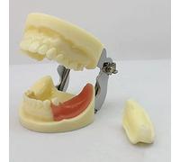 Modelo De Dientes Estándar, modelo de mandíbula de implante dental, modelo de práctica de enseñanza de cirugía oral, modelo de práctica de implante
