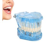 Modelo de dientes, fácil de llevar para enseñar a los niños Modelo de dientes conveniente y confiable para estudiantes para la escuela para laboratorios para maestros